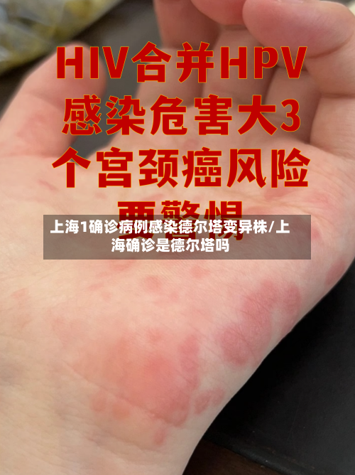 上海1确诊病例感染德尔塔变异株/上海确诊是德尔塔吗